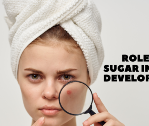 Role of Sugar in Acne Development